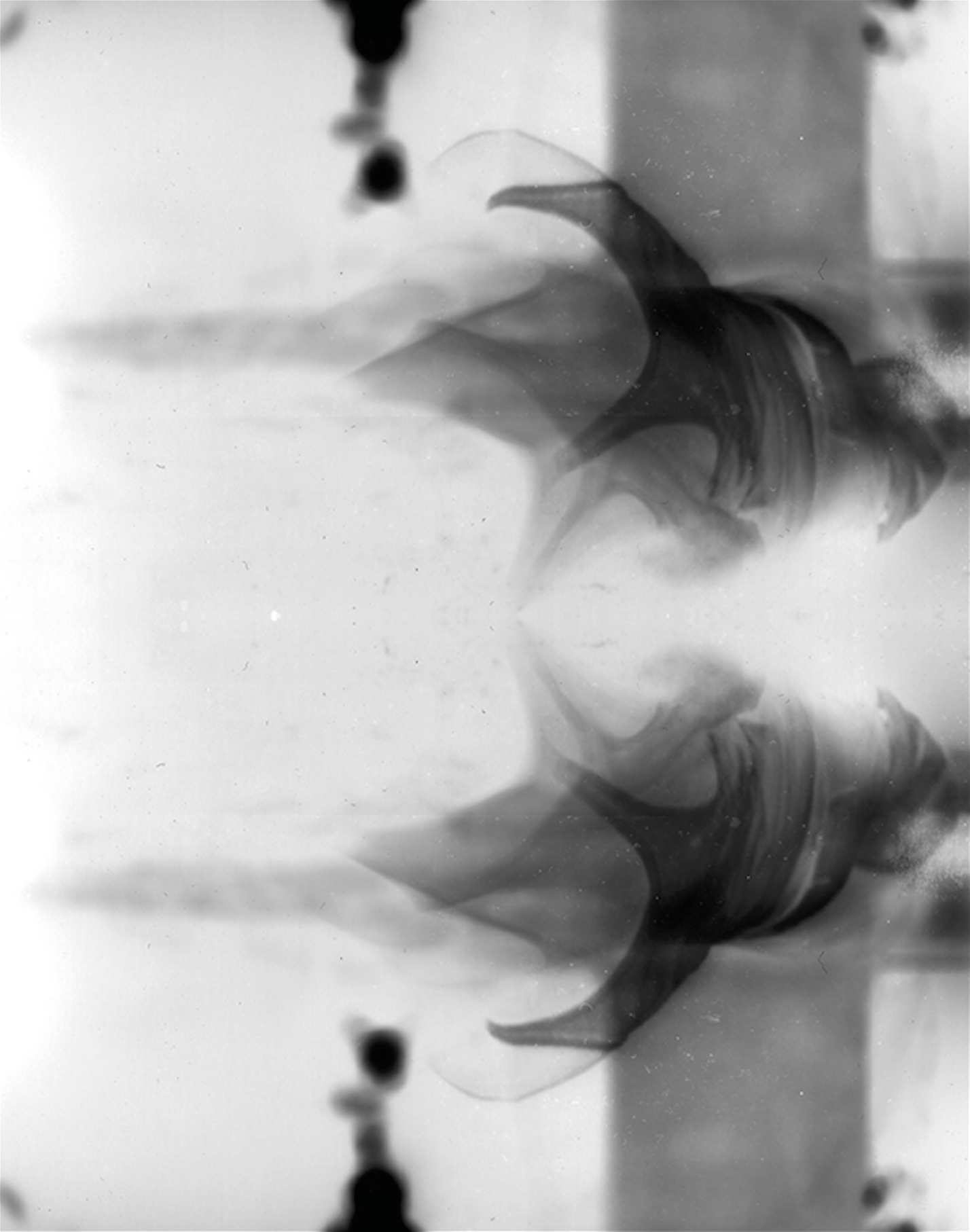 X-Ray Image